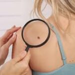 Signs It’s Time for a Skin Check
